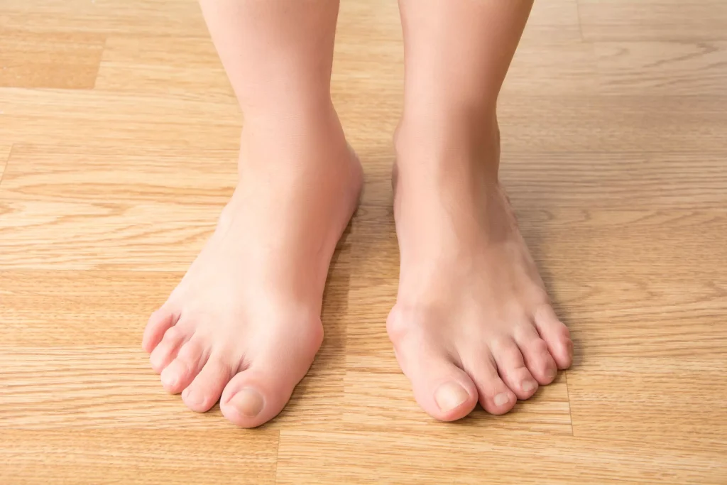 podologia-la-importancia-del-cuidado-de-nuestros-pies