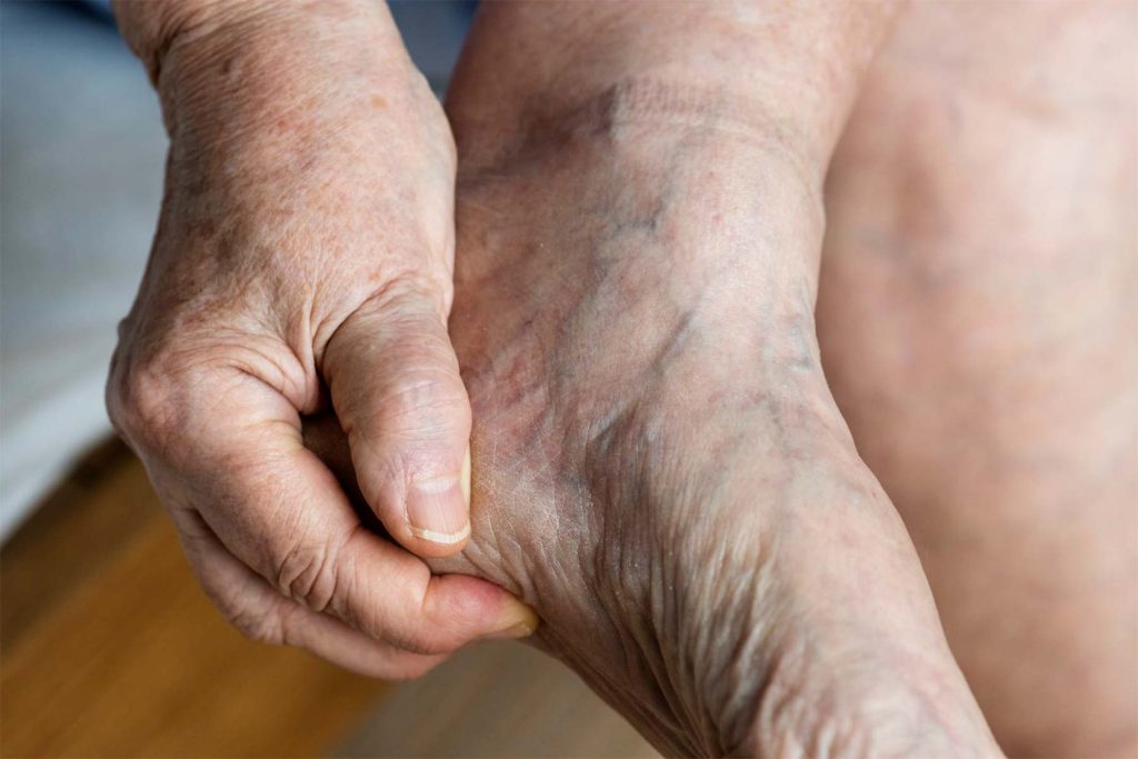 problemas-comunes-de-los-pies-en-personas-mayores
